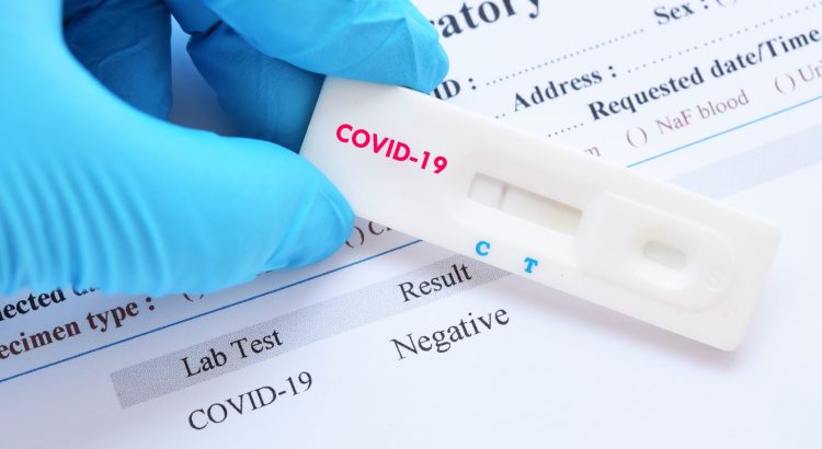 koronavirus teszt pcr